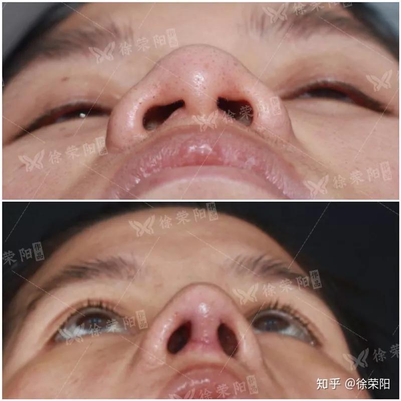 韩都衣舍 纯棉百搭短袖T恤